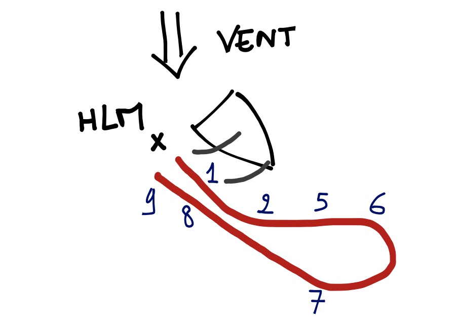 scéma explicatif de la manoeuvre d'homme à la mer